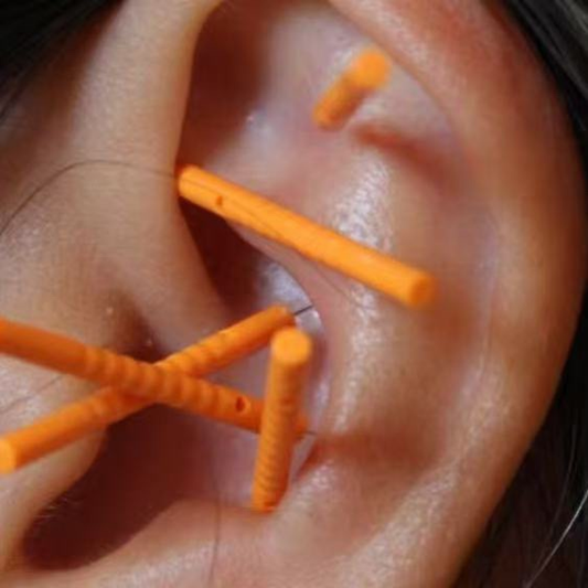 Initial Consultation + NADA